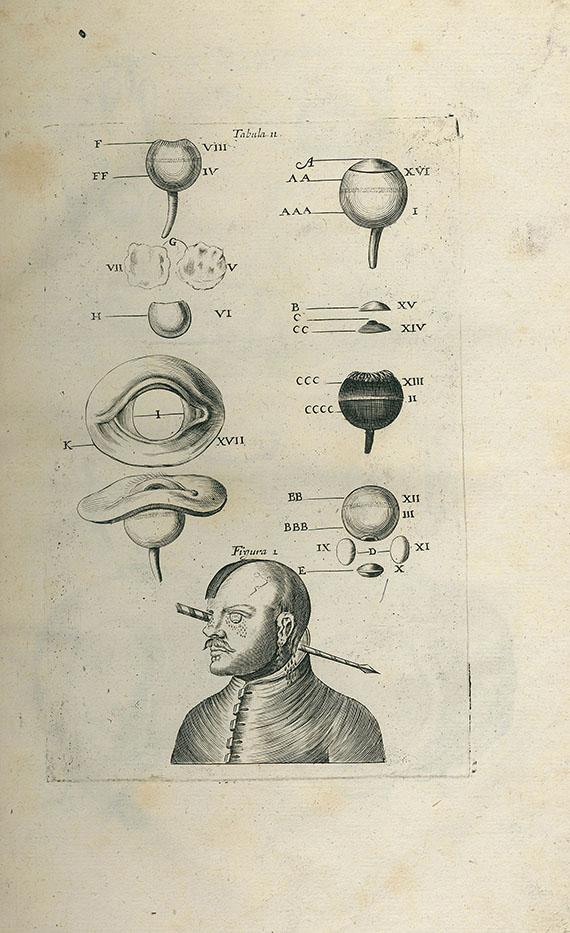 Theophil Bonet - Medicina. 2 Bde. 1686-87.