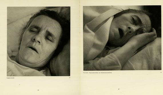 Hans Killian - Facies Dolorosa, 1934