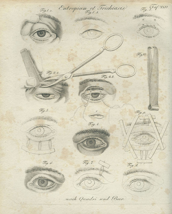 Ludwig Friedrich Froriep - Chirurgische Kupfertafeln. 1824-47. 5 Bde.